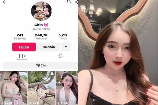 Tiktoker Chin bị nện há miệng không khép nổi
